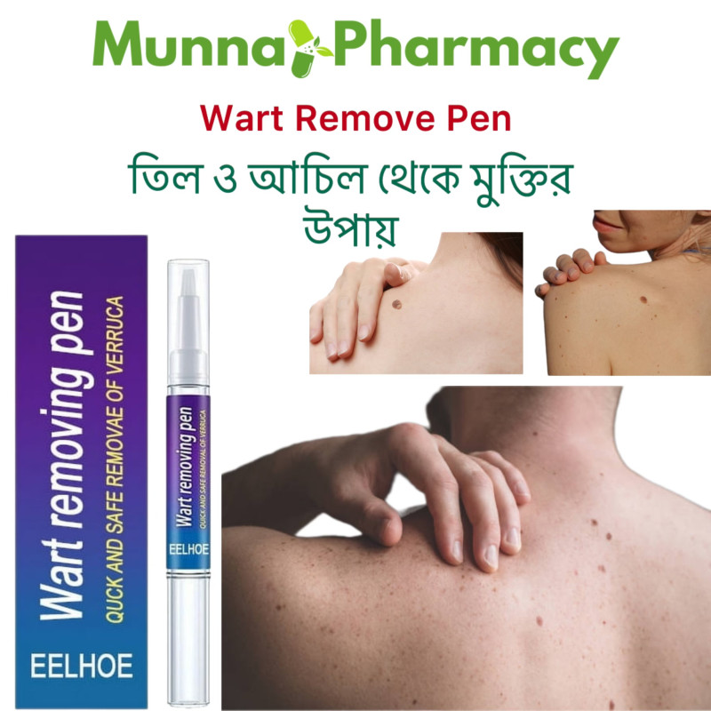 Wart Removing Pen (তিল,আচিল দূর করে )